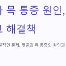 뒷골 이미지