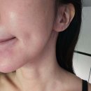 글로비지테라안티에이징의원 | 서울 강남구 신사동 탈모관리 글로비지테라안티에이징의원 위치 가격 후기