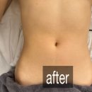 반송동133 | 축 뱃살리프팅 : 2시간 동안 뱃살만 죠져봤습니다(리얼후기) 이게 된다고???? 반송동경락