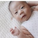 신생아 대천문 소천문 닫히는 시기 크기 위치 아기 머리의 비밀! 이미지