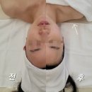 운양동 피부관리 미모종결 에스테틱
