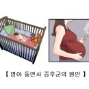 영아 돌연사 증후군[Sudden Infant Death Syndrome]소아청소년질환 이미지