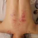 하남 미사 리본테라피 방짜유기승모근 60분 관리 후기