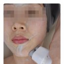 [노아르에스테틱] 리프팅과 속광을 한번에 잡는 스킨케어! 인천 부평구 노아르에스테틱♥