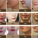리프성형외과의원