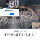 내돈내산 화곡동 파미에 치과 크라운 및 임플란트 후기