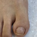 대덕대로168번길 | 대전 둔산동 갈마역 내성발톱 해결 후기 네일의아침 내성발톱 무좀 발각질 네일 문제성발
