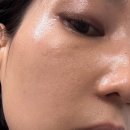 (주)에이프레이야즈 | 성인 여드름 극복 후기 및 광고에서 본 여드름 제품 리뷰 - 내돈내산