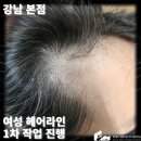미미헤어라인 이미지