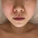 채움미 에스테틱 | 마곡 에스테틱 발산역 피부관리 ‘채움미에스테틱 마곡본점’ 동안관리 솔직후기