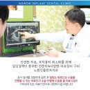 캐드캠치과기공소 이미지