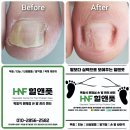 힐앤풋 이미지