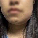 김성훈치과의원 네이버블로그
