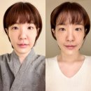 메디스케어 | 용인피부관리 전문 메디스파연 이중턱 관리 후기 기흥에스테틱 추천