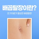 배꼽 | 배꼽성형 후기 꼼꼼히 살펴봐야 하는 이유