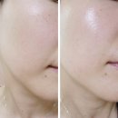 (주)토소웅 | 악건성 크림 유목민 탈출 토소웅 히알루론산 9 크림