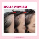 우미헤어라인 - 평택시 | 우미헤어라인