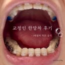 치아교정 후 1개월간 먹은 음식 후기