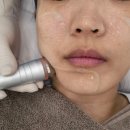 CL타워 | [오산피부관리 세교피부관리] 이로에스테틱 물방울초음파 만족후기