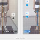 (주)비티메디 | 리메디케어센터 체형관리 후기