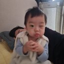 센텀안과의원 | [10개월] 개금백병원, 아기 눈물샘막힘 비루관 폐쇄, 시술후기