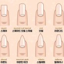 히즈네일