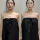 기린산소 | 인천 웨딩케어 부평 신부관리 포티산 스킨멀티플렉스 승모근관리 재방문 후기