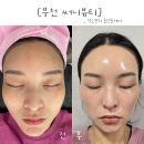 장말로 | [부천 ] 상동 예신 피부관리 추천 | 써니뷰티 기미·주근깨 올인원케어 후기