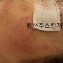 피디티 이미지