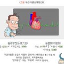 갑자기 심장 두근거림 원인 식후 이미지