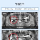 이수자연치과 이미지