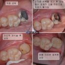 이엔치과 네이버블로그
