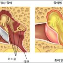 포낙보청기수원센터 이미지