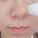 피지메디칼 이미지