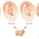 보청기전국도소매총판 네이버블로그