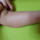 에이에스케어 이미지