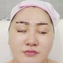 [지축 에스테틱/SJ테라피 몸다스림센터] 라라필 관리 후기