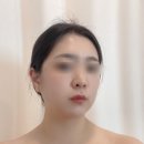 어울림빌 | 서산피부관리 루아뷰티에서 받은 슬림젯 슬리밍 앰플 관리 후기