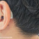 서울청담보청기 이미지