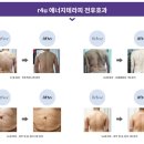 알포유베스트 이미지