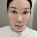 청담공드림피부과의원 | 리투오 효과 부작용 없이 효과 좋은 스킨부스터, 청담피부과 아르티의원 솔직 후기