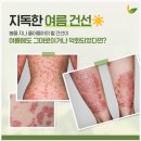 자연탕 | 노원구 두피건선, 이제는 건선한의원에서 제대로 치료하고 관리해요!