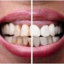 스타28치과의원 이미지