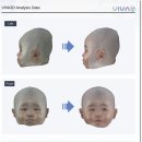 (주)지오엔테크놀로지 | 아기 두상교정 Viva 3D 헬맷 후기 2탄