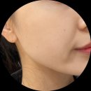 홈플러스(주) 포항점 | [포항/에스테틱] 1인 관리실 맞춤 피부관리, "더결뷰티" 스킨플래닝+물방울관리 (전/후 비교!🫧✨)