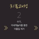 보니따의원