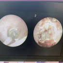 행복히어링 이미지