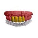 예쁜치아디자인치과기공소 이미지