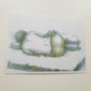 상쾌한장문외과 | 치루 수술 후기 (with 항문주위농양..)