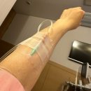 멍이가 웃통벗는날 | 오류동 삼성미래여성병원 선택 제왕절개 수술 당일 후기